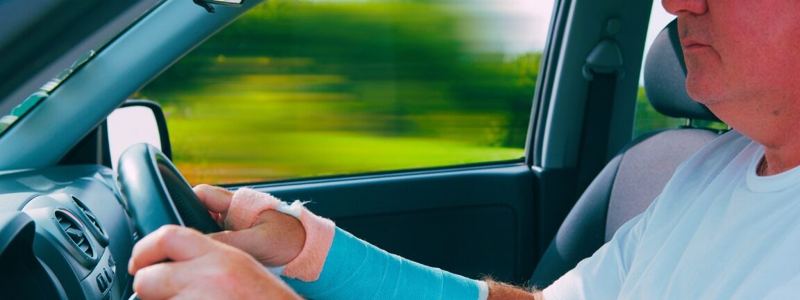 A middle aged man with a broken arm and no seatbelt driving a car.