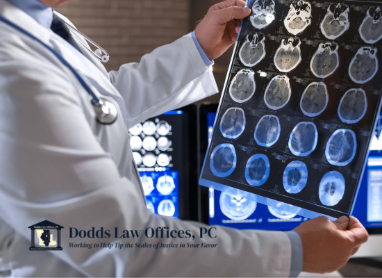 Bloomington Brain Injury Attorney at Dodds Law Office, PC